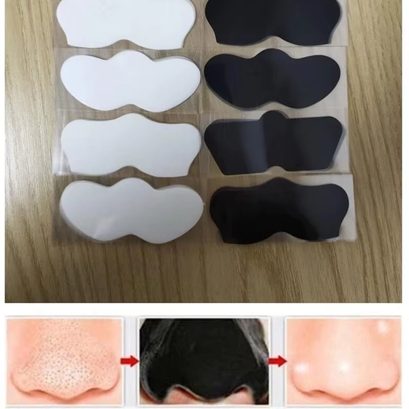 🖤 Mascarilla Removedora de Puntos Negros – Limpieza Profunda y Reducción de Poros Nasales